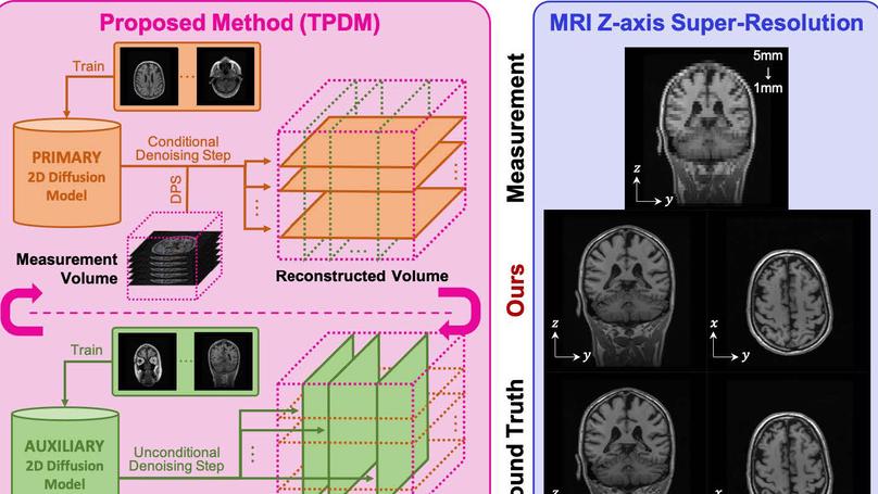 Improving 3D Imaging with Pre-Trained Perpendicular 2D Diffusion Models