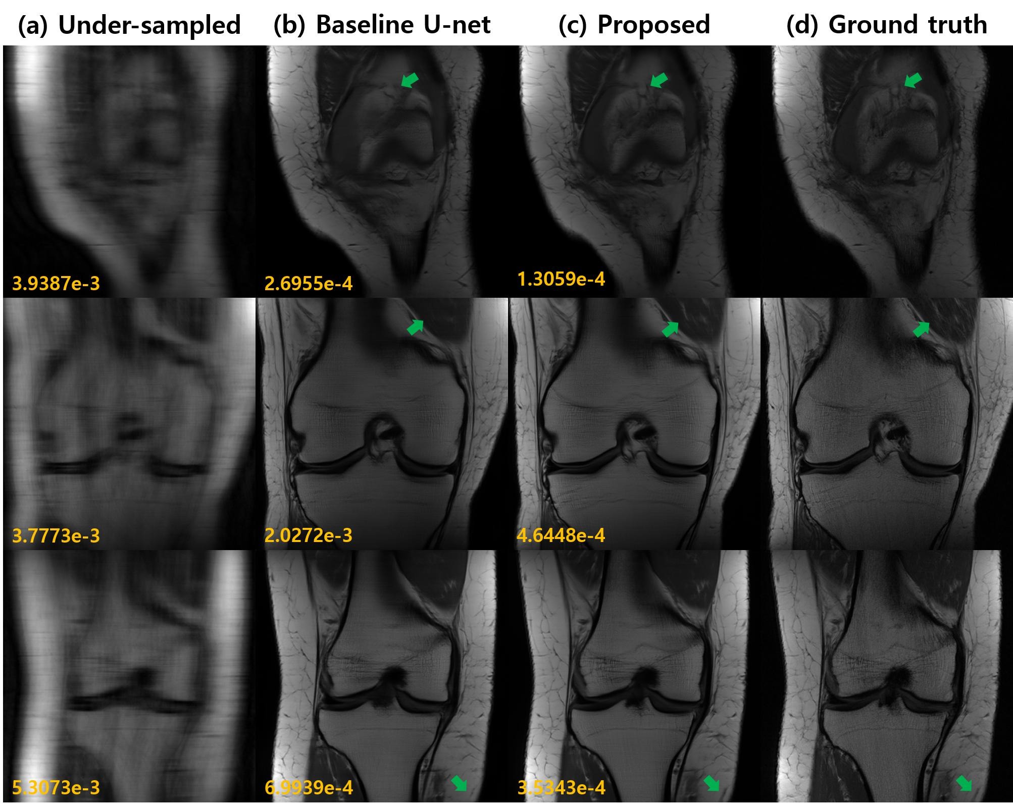 Deep Learning Fast MRI Using Channel Attention in Magnitude Domain hj