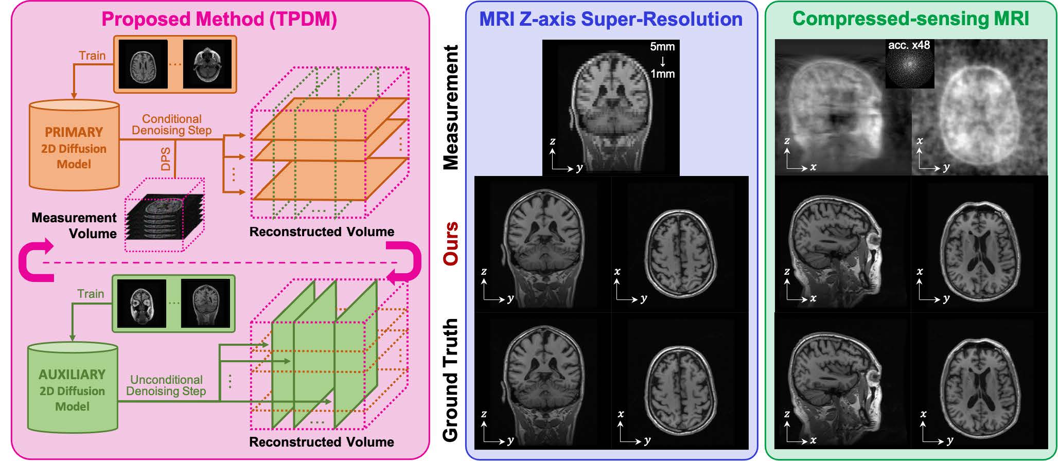 Improving 3d Imaging With Pre Trained Perpendicular 2d Diffusion Models Improving 3d Imaging With Pre Trained Perpendicular 2d Diffusion Models