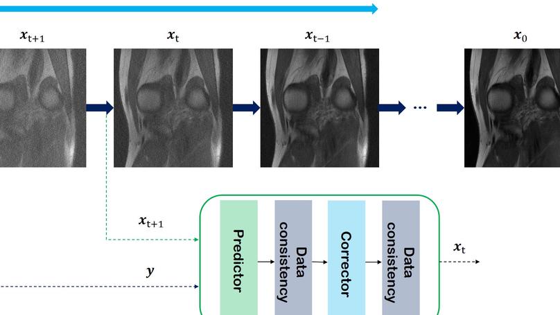 Score-based diffusion models for accelerated MRI